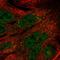TELO2 Interacting Protein 1 antibody, HPA068338, Atlas Antibodies, Immunofluorescence image 