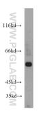 Aldehyde Dehydrogenase 6 Family Member A1 antibody, 20452-1-AP, Proteintech Group, Western Blot image 