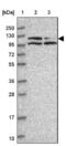 Protein Phosphatase 1 Regulatory Subunit 10 antibody, NBP2-38565, Novus Biologicals, Western Blot image 