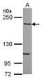 Rho GTPase Activating Protein 5 antibody, NBP2-20158, Novus Biologicals, Western Blot image 