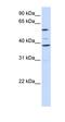 Solute Carrier Family 25 Member 16 antibody, orb325130, Biorbyt, Western Blot image 