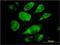 Signal Sequence Receptor Subunit 4 antibody, H00006748-M01, Novus Biologicals, Immunofluorescence image 