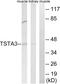 Tissue Specific Transplantation Antigen P35B antibody, LS-B9837, Lifespan Biosciences, Western Blot image 
