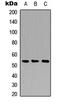 Cathepsin A antibody, LS-C354308, Lifespan Biosciences, Western Blot image 