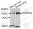 Platelet Derived Growth Factor Receptor Beta antibody, A2180, ABclonal Technology, Western Blot image 
