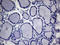 Activin A Receptor Type 2A antibody, LS-C794046, Lifespan Biosciences, Immunohistochemistry paraffin image 