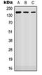 Roundabout Guidance Receptor 2 antibody, orb304557, Biorbyt, Western Blot image 