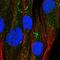 Glycerol-3-Phosphate Acyltransferase 2, Mitochondrial antibody, HPA036841, Atlas Antibodies, Immunofluorescence image 