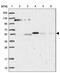 Adhesion Molecule With Ig Like Domain 1 antibody, PA5-61164, Invitrogen Antibodies, Western Blot image 