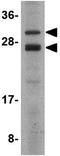 COP9 Signalosome Subunit 8 antibody, GTX85400, GeneTex, Western Blot image 