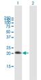 Regulator Of G Protein Signaling 10 antibody, H00006001-B01P, Novus Biologicals, Western Blot image 