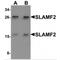 CD48 Molecule antibody, MBS150899, MyBioSource, Western Blot image 