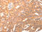 Bradykinin Receptor B2 antibody, CSB-PA574868, Cusabio, Immunohistochemistry paraffin image 