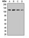 NEDD4 E3 Ubiquitin Protein Ligase antibody, LS-C667926, Lifespan Biosciences, Western Blot image 