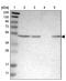 Epithelial Stromal Interaction 1 antibody, PA5-53595, Invitrogen Antibodies, Western Blot image 