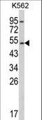 Cytochrome P450 Family 2 Subfamily E Member 1 antibody, LS-C167226, Lifespan Biosciences, Western Blot image 