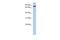 Semaphorin-4B antibody, A08999, Boster Biological Technology, Western Blot image 