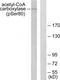 Acetyl-CoA Carboxylase Alpha antibody, TA313413, Origene, Western Blot image 