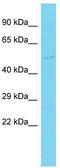 WD Repeat And SOCS Box Containing 1 antibody, TA343186, Origene, Western Blot image 