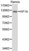 Dual specificity protein kinase TTK antibody, LS-C192281, Lifespan Biosciences, Western Blot image 