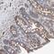 Isoleucyl-TRNA Synthetase 2, Mitochondrial antibody, PA5-55118, Invitrogen Antibodies, Immunohistochemistry paraffin image 