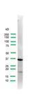 Uroplakin 3A antibody, PA5-32636, Invitrogen Antibodies, Western Blot image 