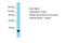 Thyroid Hormone Receptor Associated Protein 3 antibody, A05150, Boster Biological Technology, Western Blot image 