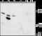 Transient Receptor Potential Cation Channel Subfamily M Member 6 antibody, GTX16611, GeneTex, Western Blot image 
