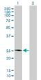 Phospholipase A2 Group IVD antibody, H00283748-B01P, Novus Biologicals, Western Blot image 