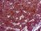 Perilipin 2 antibody, GTX03304, GeneTex, Immunohistochemistry paraffin image 
