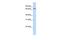 Propionyl-CoA Carboxylase Subunit Alpha antibody, GTX47779, GeneTex, Western Blot image 