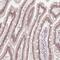 Zinc Finger Protein 488 antibody, NBP2-48819, Novus Biologicals, Immunohistochemistry paraffin image 