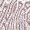 Zinc Finger Protein 488 antibody, NBP2-48819, Novus Biologicals, Immunohistochemistry paraffin image 