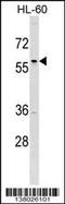 Transcription Factor AP-2 Delta antibody, TA324623, Origene, Western Blot image 