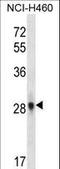Fibroblast Growth Factor 10 antibody, LS-C166128, Lifespan Biosciences, Western Blot image 