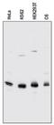 Cyclin Dependent Kinase 2 antibody, NB100-2721, Novus Biologicals, Western Blot image 