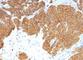 Parathyroid Hormone antibody, NBP2-48374, Novus Biologicals, Immunohistochemistry frozen image 