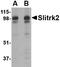 SLIT And NTRK Like Family Member 2 antibody, AP22670PU-N, Origene, Western Blot image 