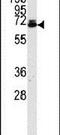 Ubiquilin 2 antibody, PA5-12076, Invitrogen Antibodies, Western Blot image 