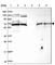 Protein Kinase C And Casein Kinase Substrate In Neurons 2 antibody, HPA049854, Atlas Antibodies, Western Blot image 