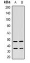 Inositol-Tetrakisphosphate 1-Kinase antibody, orb382550, Biorbyt, Western Blot image 