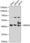 Protein Arginine Methyltransferase 6 antibody, 23-203, ProSci, Western Blot image 