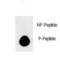 Microtubule Associated Protein 1 Light Chain 3 Beta antibody, LS-C163592, Lifespan Biosciences, Dot Blot image 