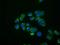 Interferon Induced Protein With Tetratricopeptide Repeats 1 antibody, MA5-25050, Invitrogen Antibodies, Immunocytochemistry image 