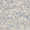 Sphingosine Kinase 1 antibody, LS-C330808, Lifespan Biosciences, Immunohistochemistry paraffin image 