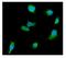 DEAD-Box Helicase 6 antibody, M03826-1, Boster Biological Technology, Immunofluorescence image 