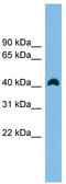 Ankyrin Repeat Domain 42 antibody, TA344033, Origene, Western Blot image 