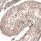 CDK5 Regulatory Subunit Associated Protein 2 antibody, NBP2-59027, Novus Biologicals, Immunohistochemistry paraffin image 