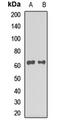 Staufen Double-Stranded RNA Binding Protein 2 antibody, orb412183, Biorbyt, Western Blot image 