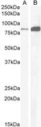 Cholecystokinin B Receptor antibody, LS-B2325, Lifespan Biosciences, Western Blot image 